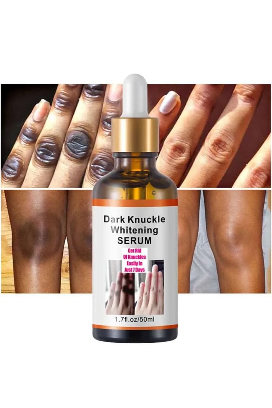 Dark Knuckle Whitening Serum